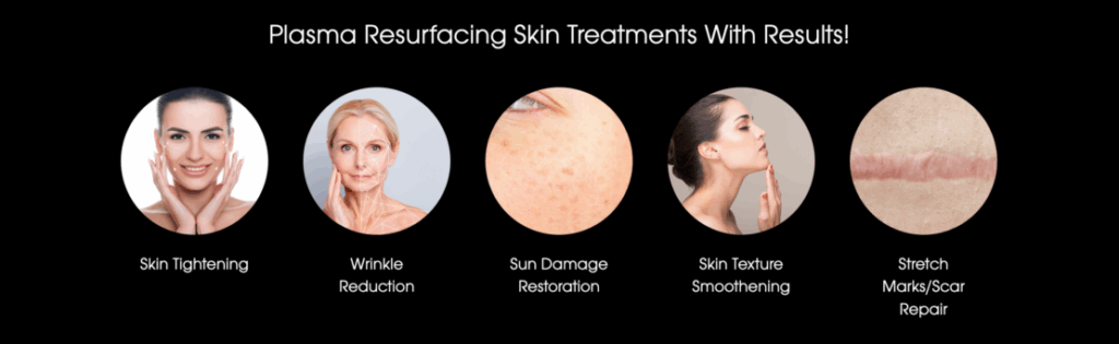 beyond wrinkle blog 5