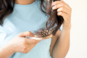 Restore Your Hair and Your Confidence with Alma TED at LIGHT Family Wellness Hair Loss Clinic